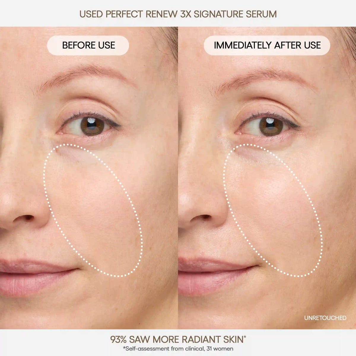 Perfect Renew 3X Signature Serum