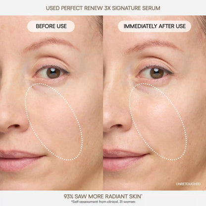 Perfect Renew 3X Signature Serum